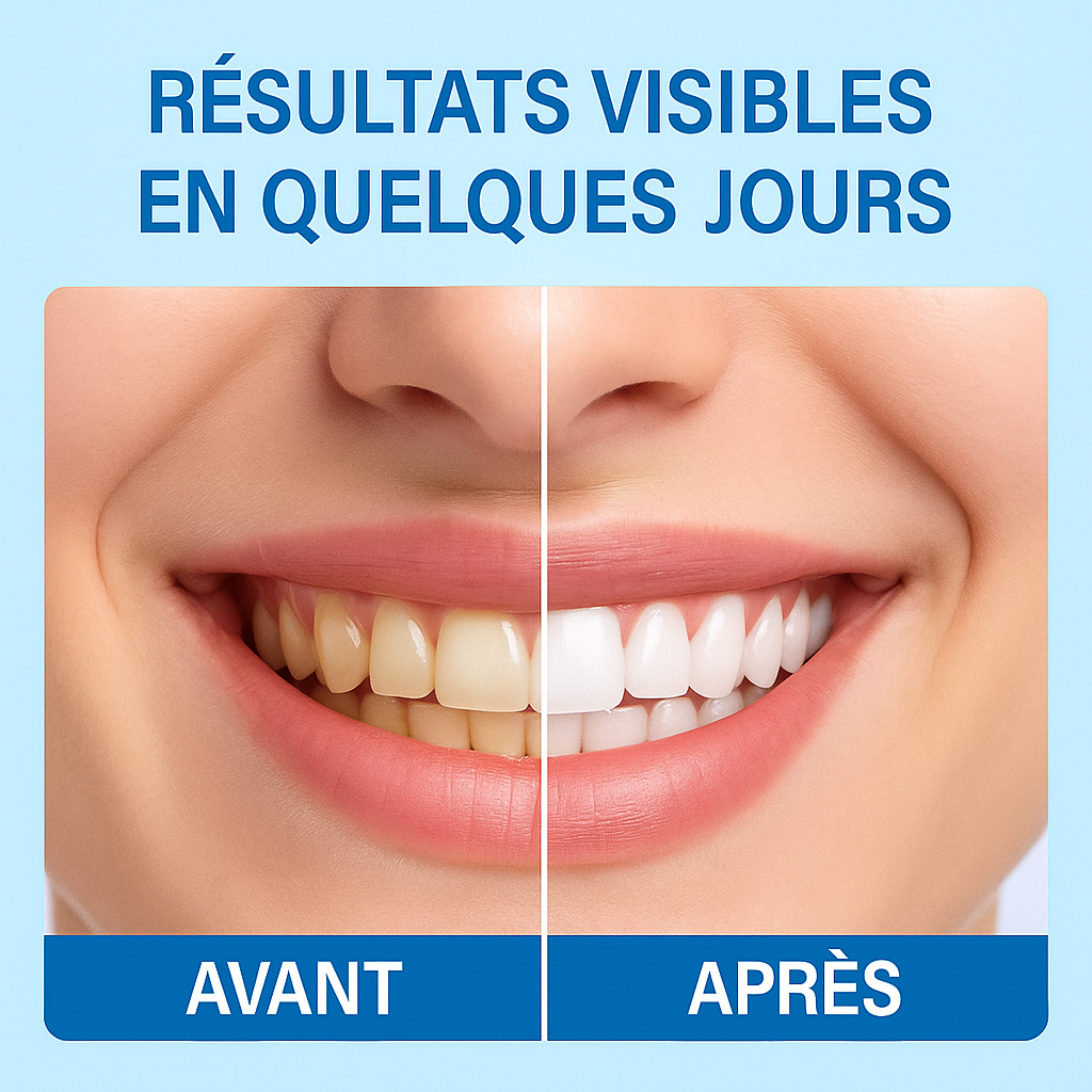 Poudre Blanchissante 5 JOURS